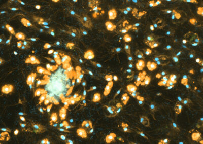 Cells that appear blue and orange using fluorescenct microscopy