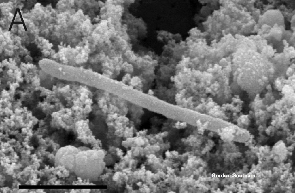 Scanning electron micrograph image of C.D. audaxviator microbe taken from a mine in South Africa.
