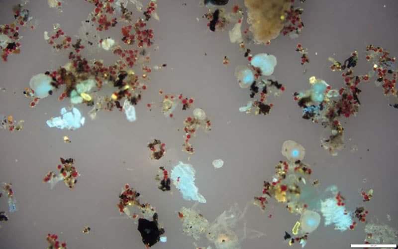microscope view of snow algae sample