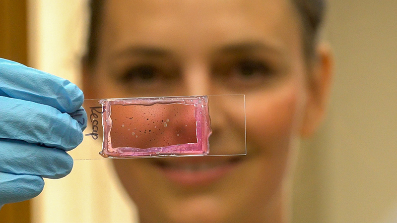 Dr. Brugger holding a slide with pollen grains visible.